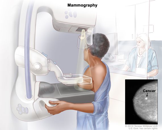 Things about D Mammogram in Paterson, NJ